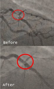 What they fixed