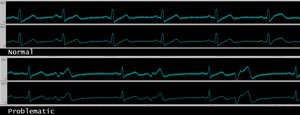 Rhythm Comparison